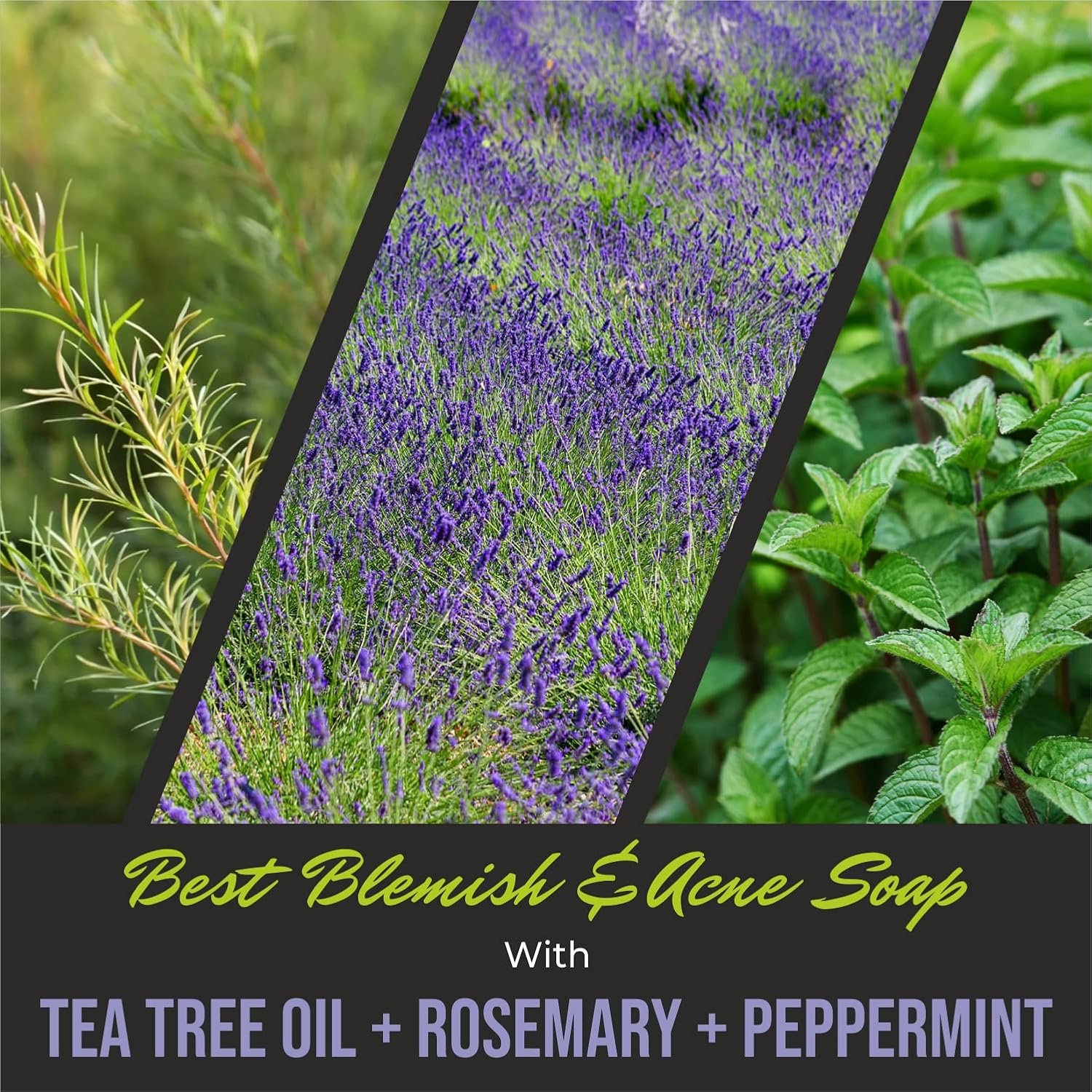 First Botany, ALL Natural Body Wash - Fights Body Odor, Athlete's Foot, Jock Itch, Nail Issues, Dandruff, Acne, Eczema, Shower Gel for Women & Men, Skin Cleanser -16 fl oz (Rosemary Mint)